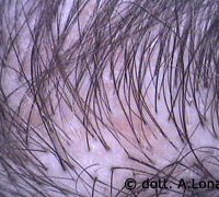 capelli4